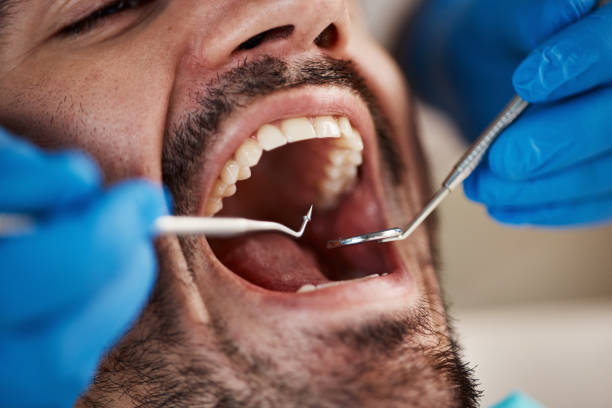 Best Emergency Treatment for Dental Infections or Abscesses in Stansbury Park, UT